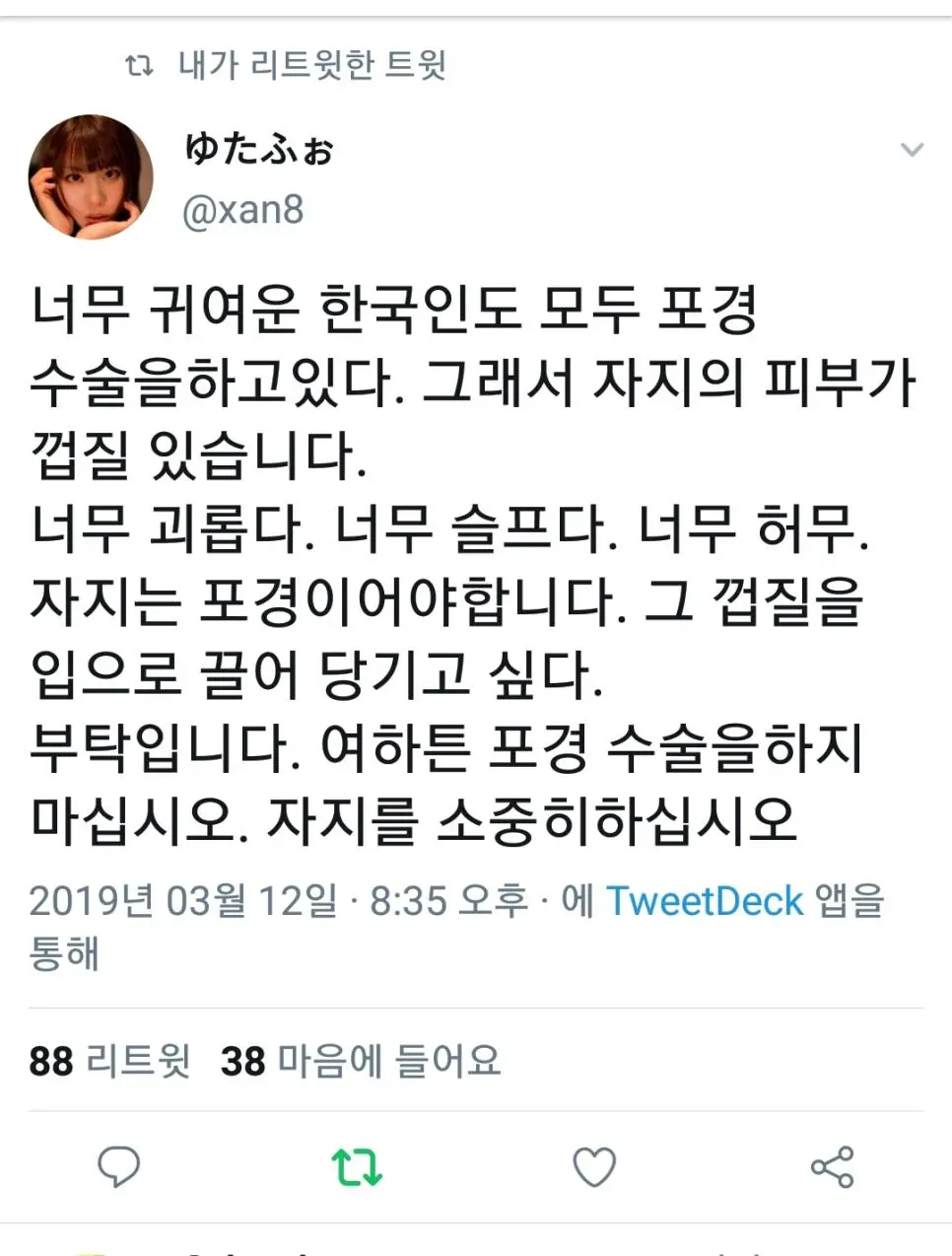 여러분 포경수술 하지마세요!!.jpg | mbong.kr 엠봉