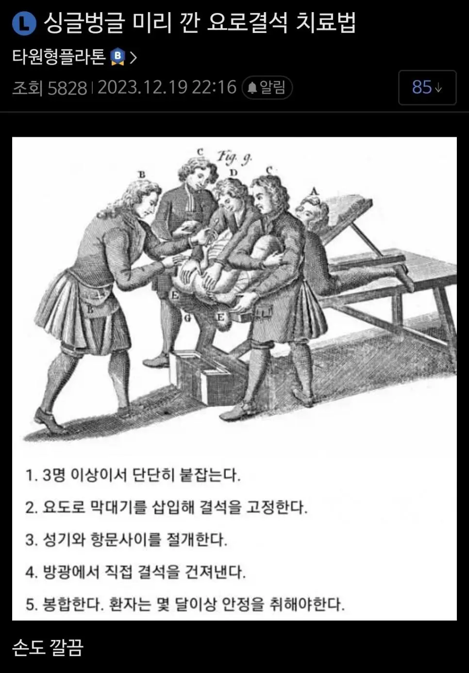 공포공포 옛날 요로결석 수술법 | mbong.kr 엠봉
