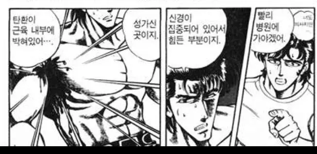 총맞았을때 외과적수술없이 셀프제거 방법.JPG | mbong.kr 엠봉