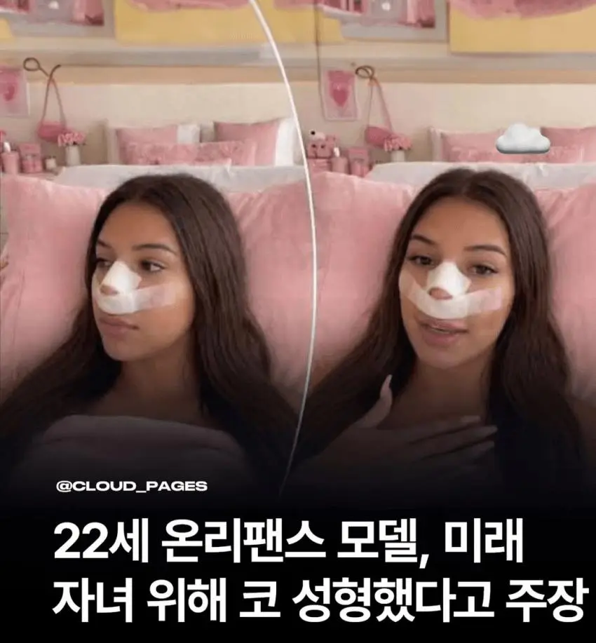 한 여자가 코성형을 한 이유 | 인스티즈