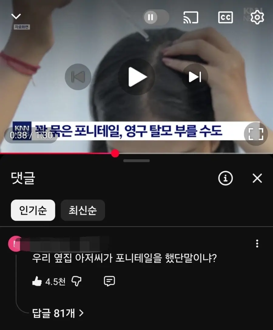 의외로 탈모를 유발하는 습관 | mbong.kr 엠봉