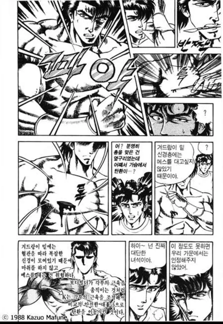 총맞았을때 외과적수술없이 셀프제거 방법.JPG | mbong.kr 엠봉