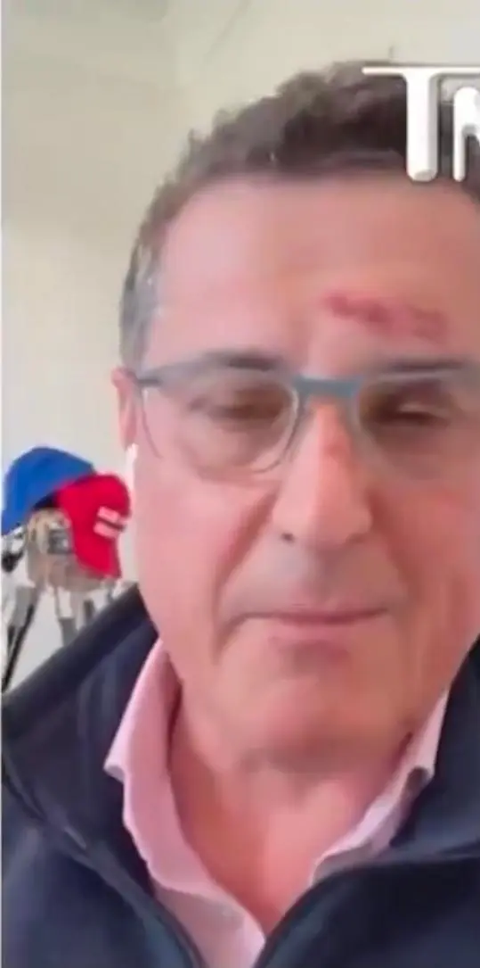 미국에서 난리난 할리우드 배우 폭행 사건 근황 | mbong.kr 엠봉