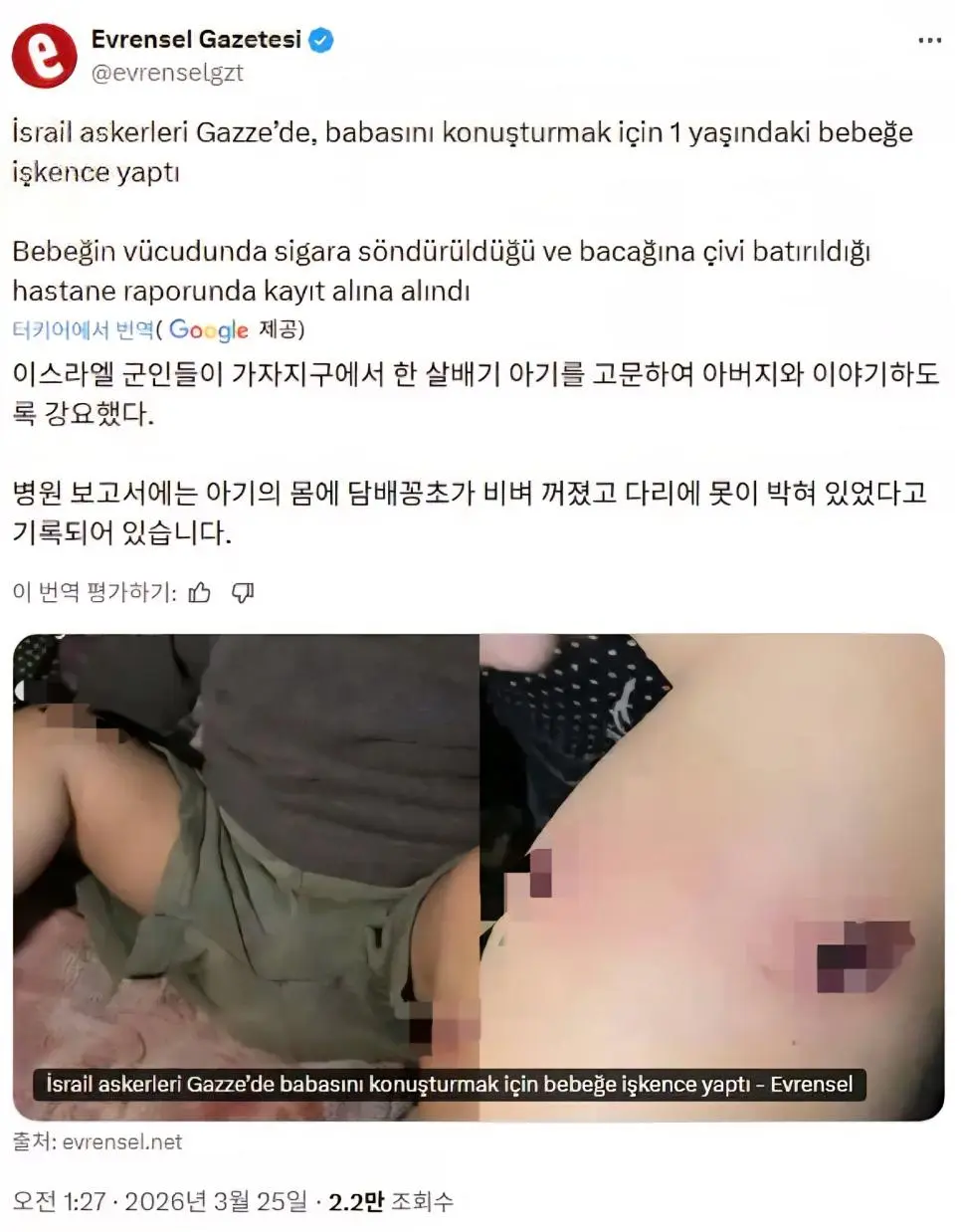 혐) 이스라엘군, 아버지 자백받으려 18개월 아기 담뱃불 고문 논란 | mbong.kr 엠봉