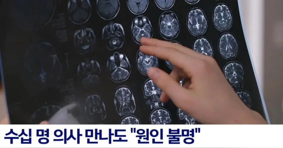 인간 의사가 25년동안 고치지 못한 병을 AI가 1초 만에 진단한 사례 | mbong.kr 엠봉