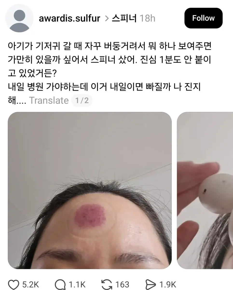 피해자가 속출하고있는 제품 근황 | mbong.kr 엠봉
