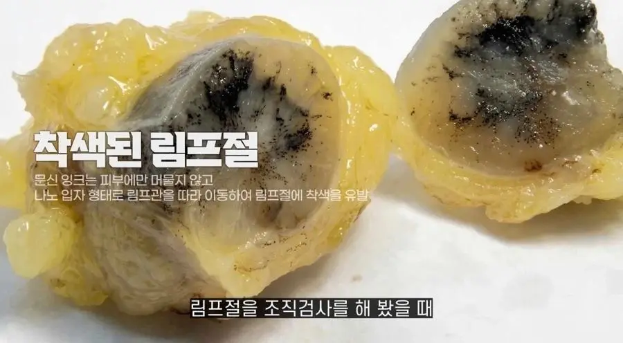 오늘도 무신 연전연승 ㅋㅋ | mbong.kr 엠봉