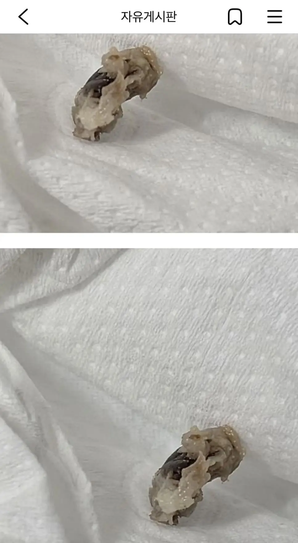 약혐) 평생 배꼽안에 있던 어떤게 빠진 여시 | mbong.kr 엠봉