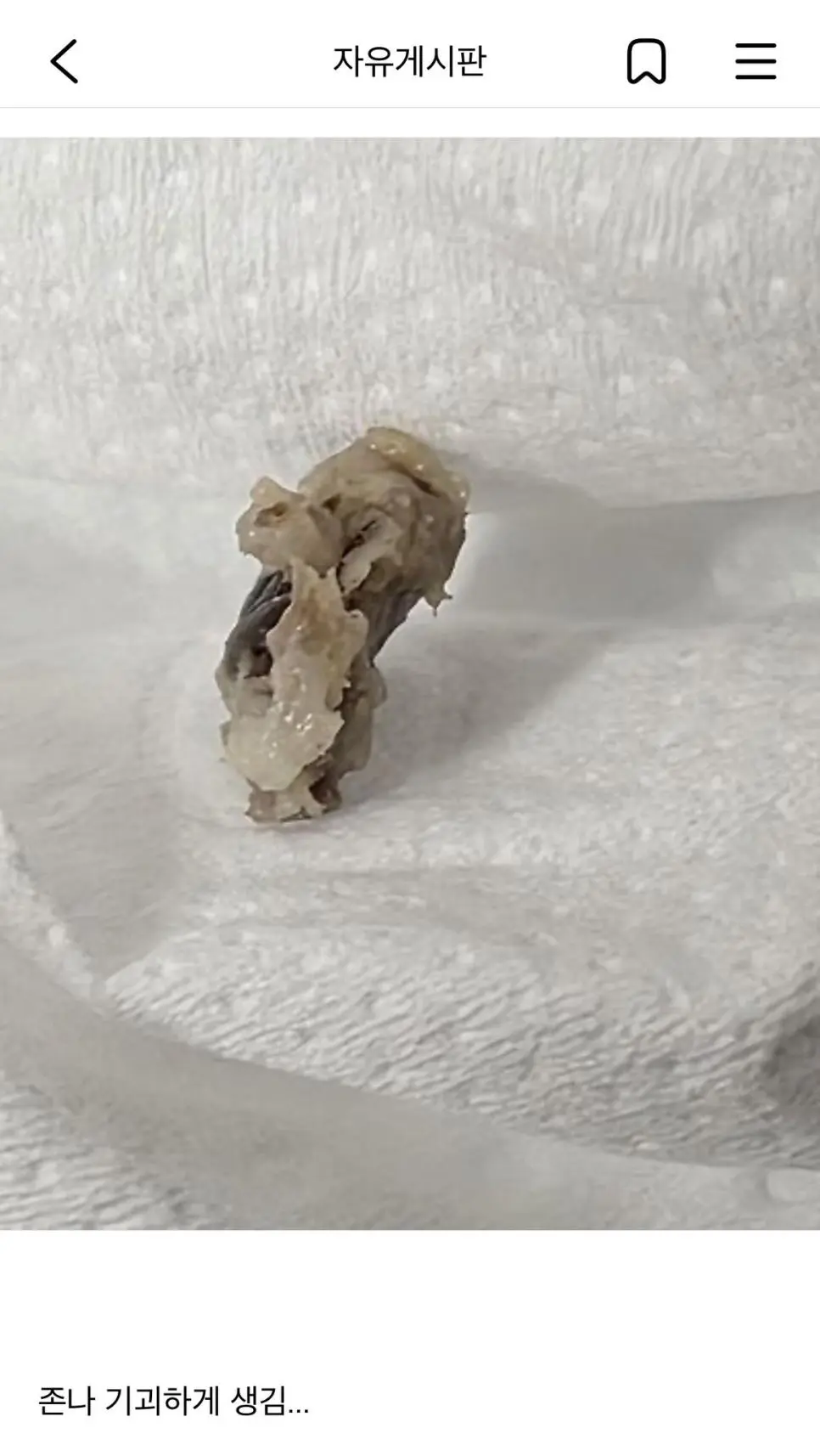 약혐) 평생 배꼽안에 있던 어떤게 빠진 여시 | mbong.kr 엠봉