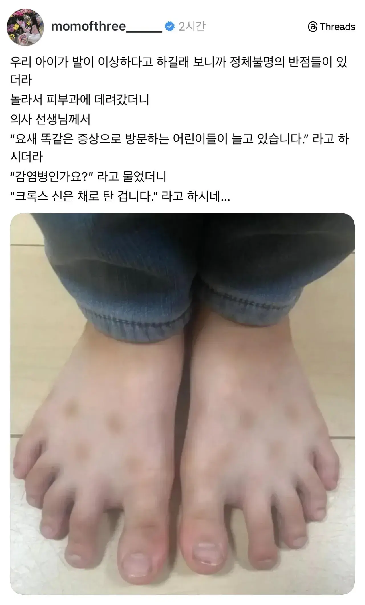 요즘 애들 사이에 유행하는 피부병 | mbong.kr 엠봉