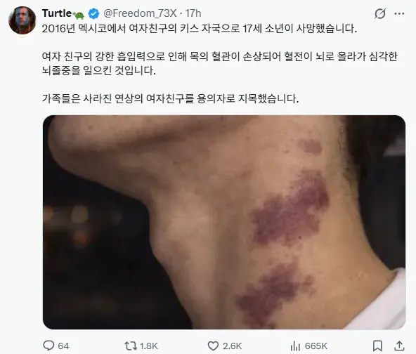 키스의 위험성 | mbong.kr 엠봉