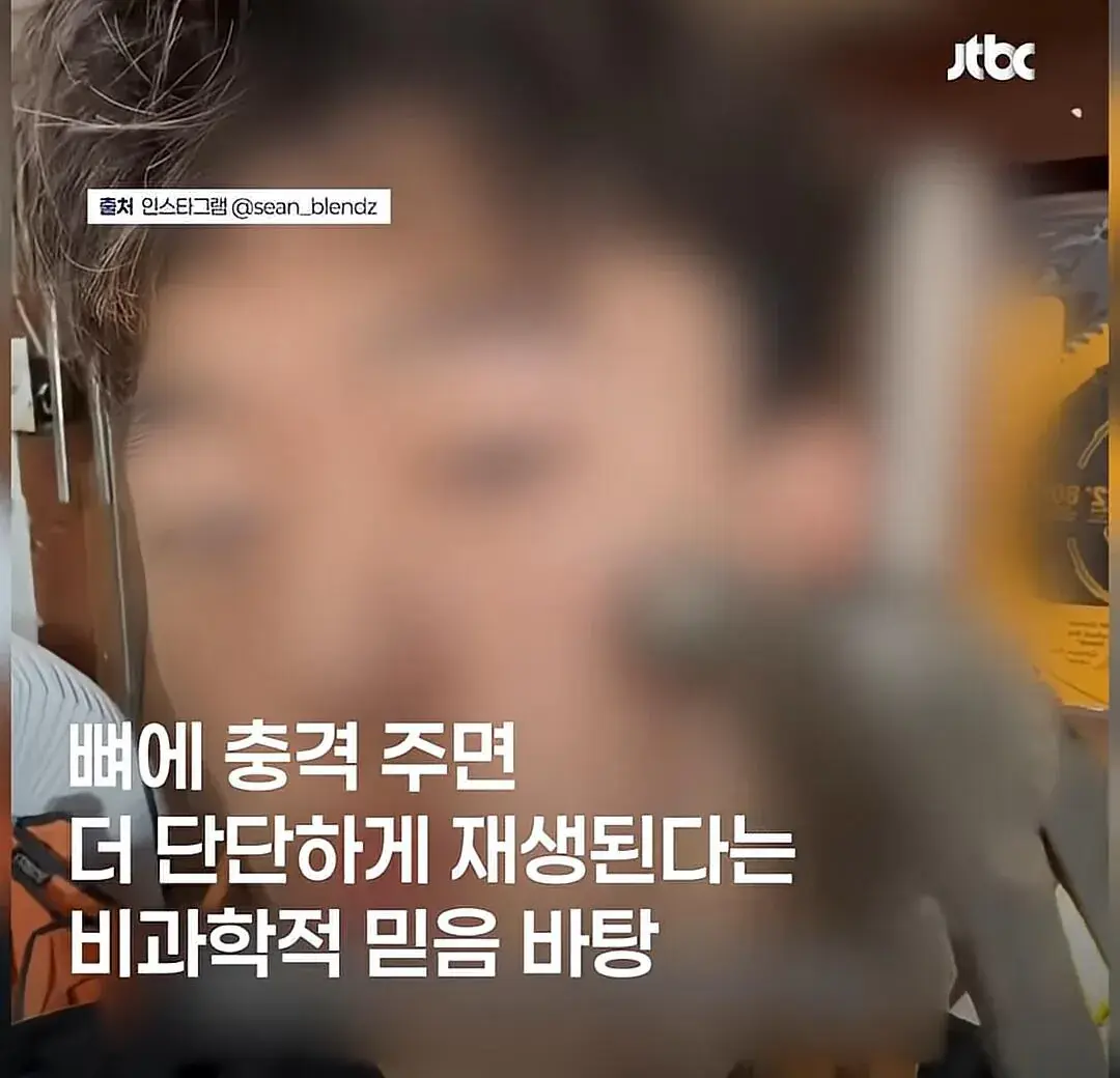 요즘 해외 남성들에게 유행한다는 망치 에스테틱 | mbong.kr 엠봉