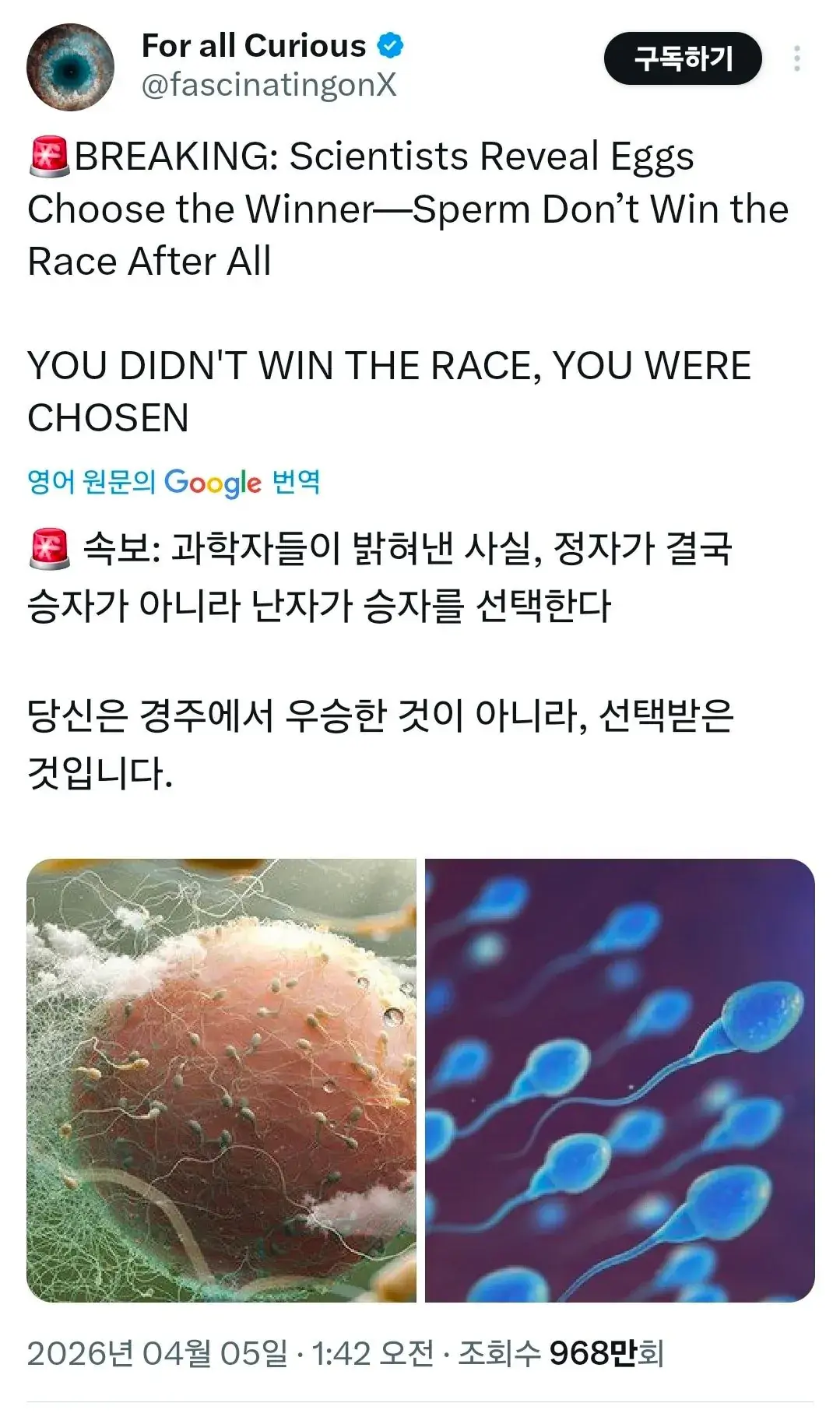 임신에 대한 충격적인 사실 | mbong.kr 엠봉