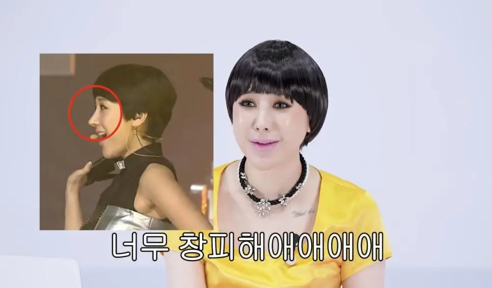 서인영 코(끝)성형 5번 하기 전 | mbong.kr 엠봉