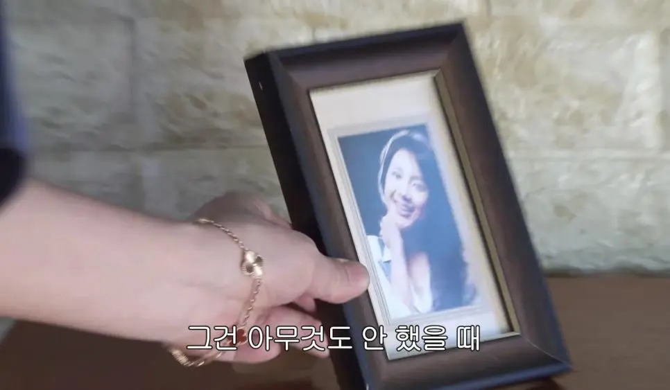 서인영 코(끝)성형 5번 하기 전 | mbong.kr 엠봉