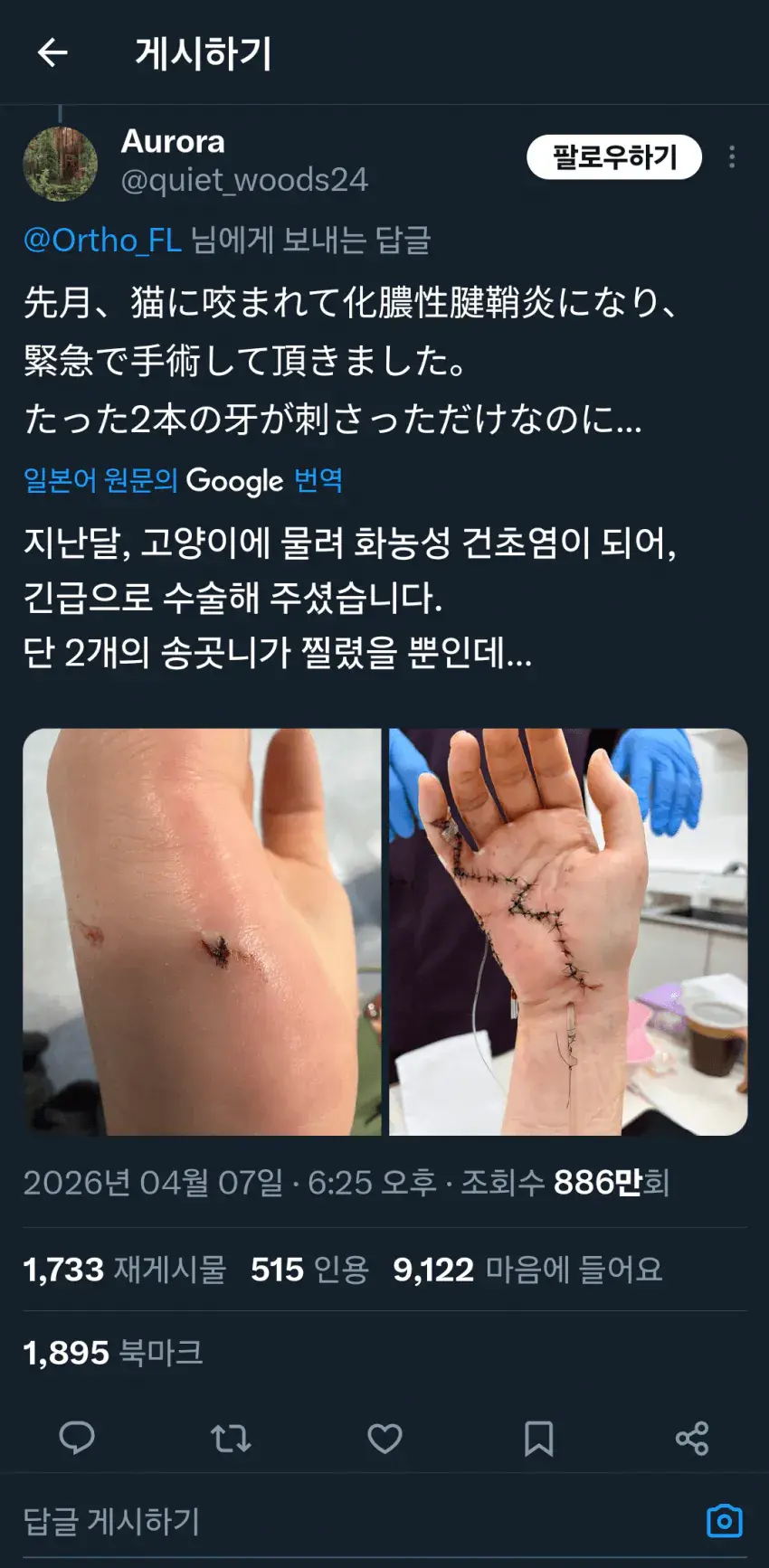 상처주의) 고양이 물림사고의 위험성. | mbong.kr 엠봉