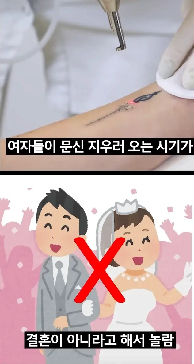 여자들이 문신을 지우는 시기 | mbong.kr 엠봉