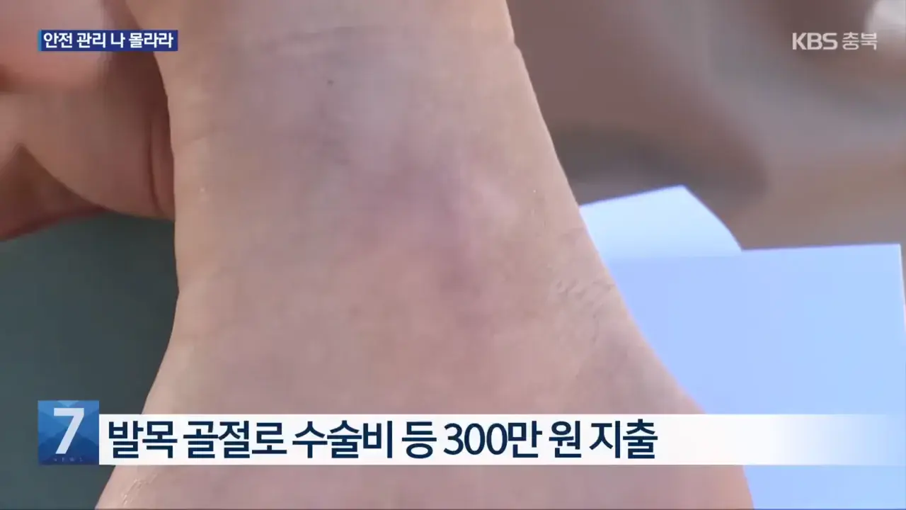 인도 걷다가 다친 시민에 소송 건 청주시 | mbong.kr 엠봉