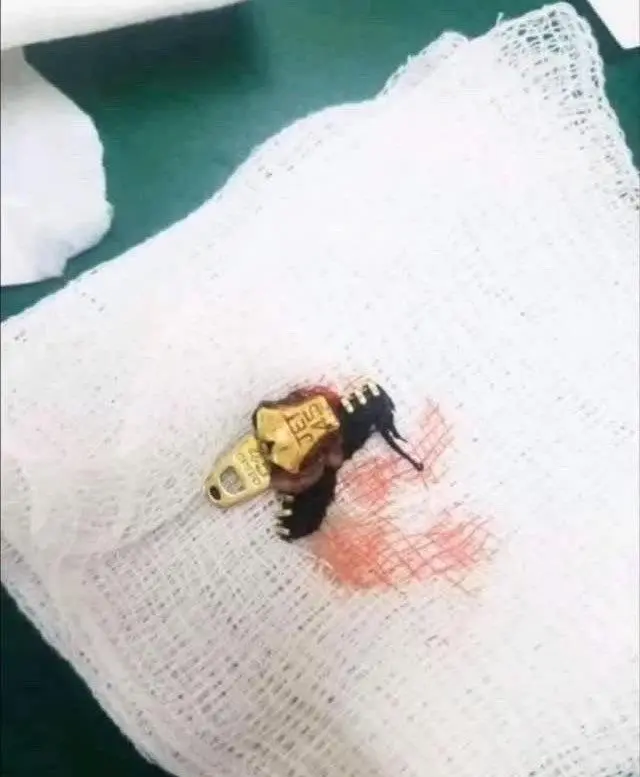 약혐) 자세히보면 왠지 오금 저리는 사진 | mbong.kr 엠봉