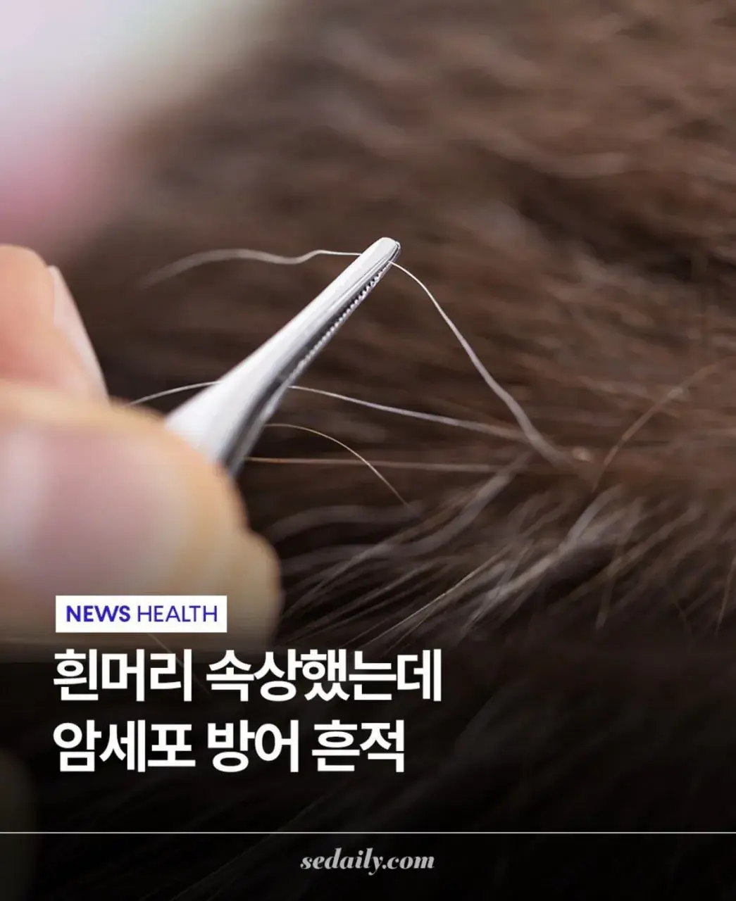 도쿄대에서 밝혀낸 흰머리의 비밀 | mbong.kr 엠봉