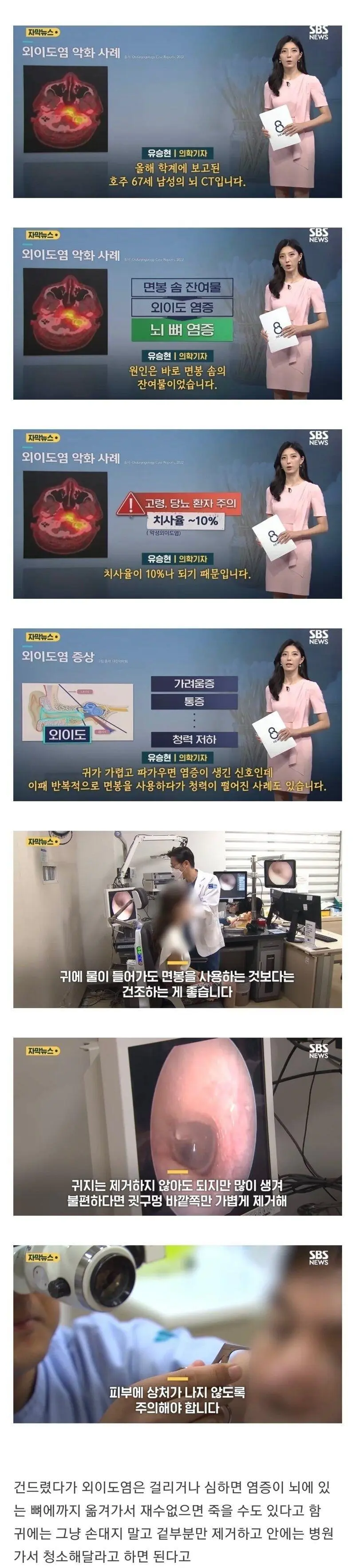 귓구멍은 소중하게 | 인스티즈